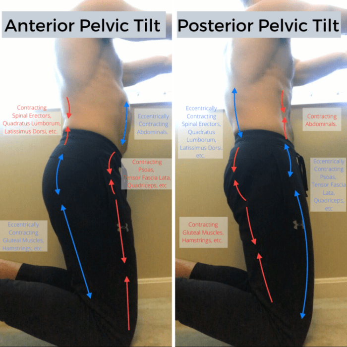 Tilt pelvic posterior sacral pelvis correction posture positioning permobil