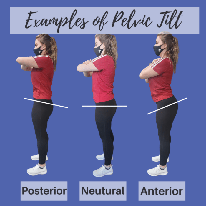 Anterior pelvic tilt and tmj