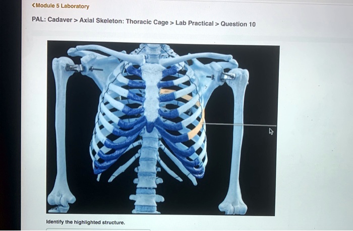 Pal cadaver axial skeleton skull lab practical question 11