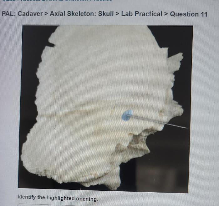 Pal cadaver axial skeleton skull lab practical question 11