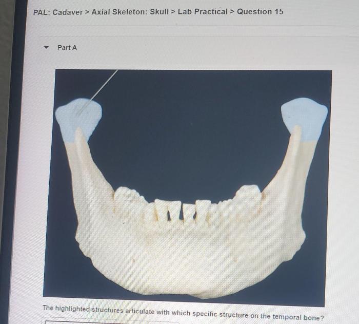 Pal cadaver axial skeleton skull lab practical question 11