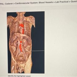 Pal cadaver axial skeleton skull lab practical question 11