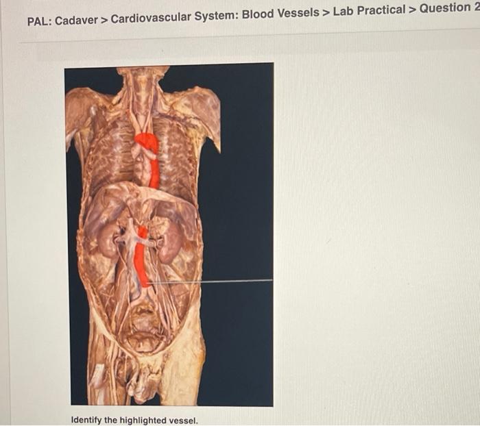 Pal cadaver axial skeleton skull lab practical question 11